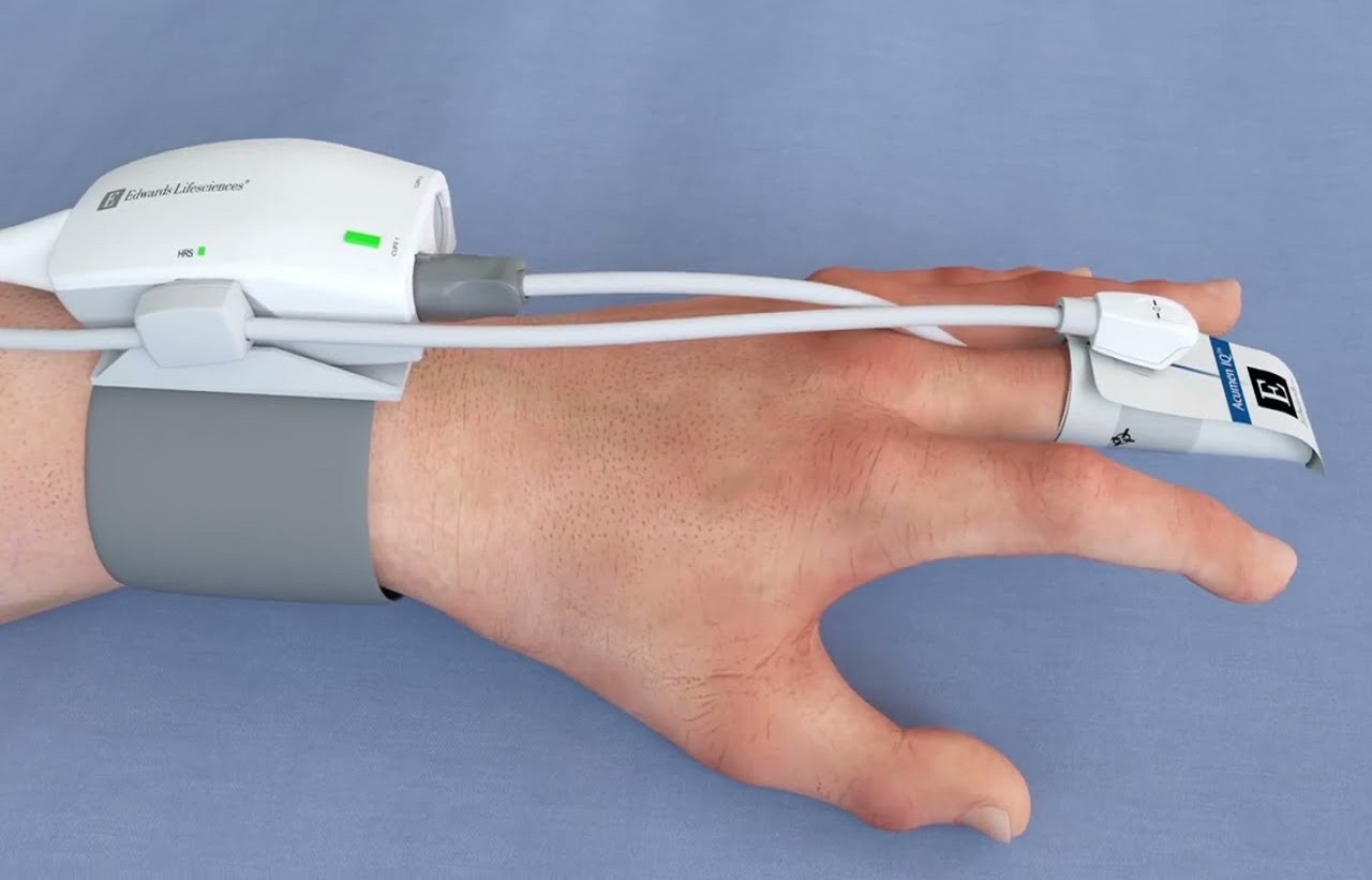 See how Acumen IQ cuff can be effortlessly applied to

                         your patient’s finger.